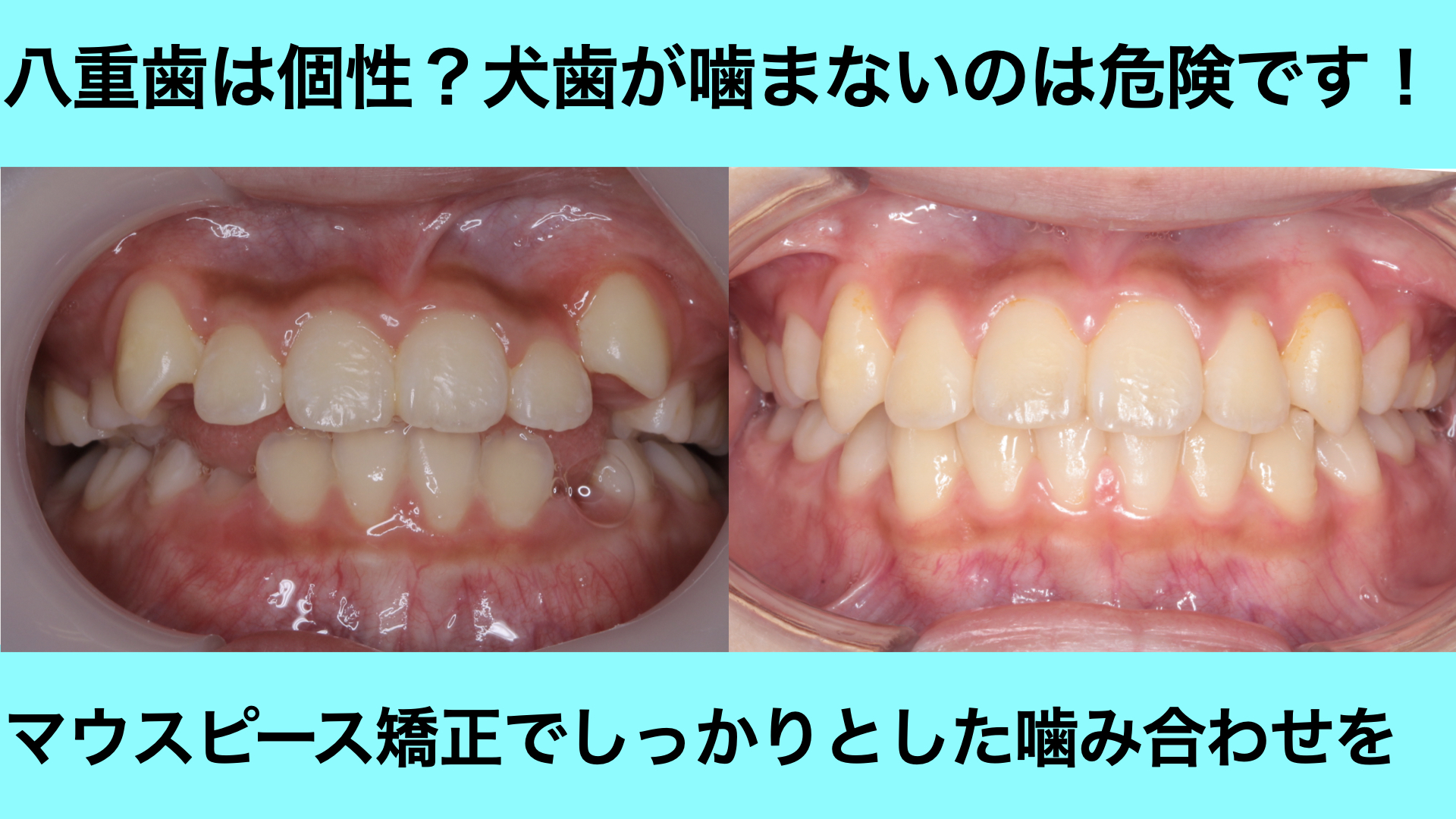 投稿 - 茨木市の歯医者「てらい歯科クリニック」